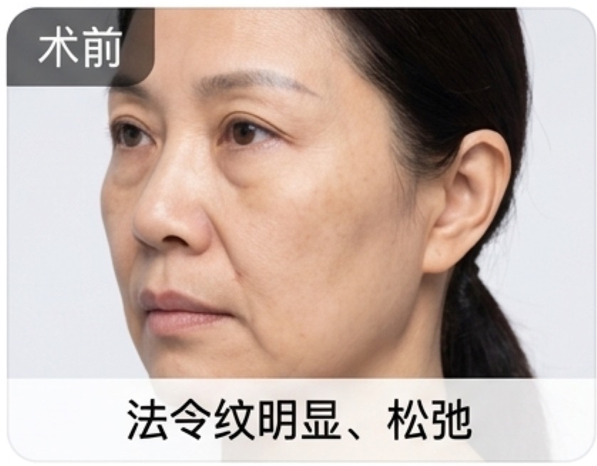 医美影像库示例图一